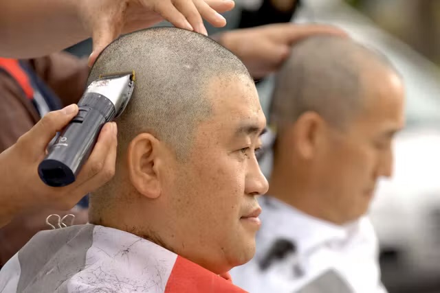 En Corée du Sud, la calvitie s’invite au sommet de l’État et divise la société